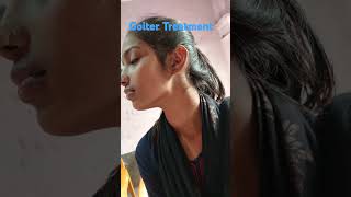 Goiter Homeopathc Treatment [upl. by Wye]