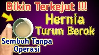 Obat hernia alami paling ampuh  Cara mengobati hernia atau turun berok tanpa operasi [upl. by Noyek]