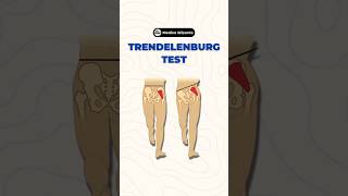 Understanding the Trendelenburg Test A key assessment for hip stability amp gluteal muscle function [upl. by Selwin]