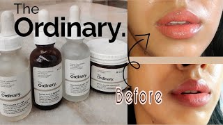 The Ordinary Skincare for Hyperpigmentation  Uneven Skintone Best Products to fade pigmentation [upl. by Neehsas]