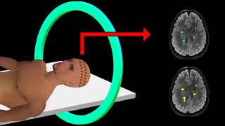 PET Scan  How It Works  Animation [upl. by Maurer]