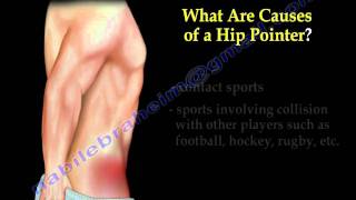 Hip Pointer  Everything You Need To Know  Dr Nabil Ebraheim [upl. by Irik]