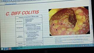 Case based study about Pseudomembranous Colitis [upl. by Berkin]