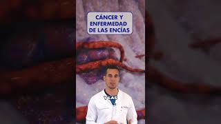 ¡Precaución El CÁNCER y su posible RELACIÓN con la ENFERMEDAD de las ENCÍAS [upl. by Kussell]