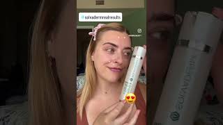 My Unique Skincare Routine with Solvaderm Blemish Treatment Lash Serum amp More [upl. by Siouxie907]