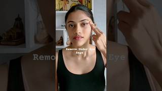 Best Treatment for Under Eye Bags 👆🏼watch full video skincare shorts facemassage [upl. by Forster]