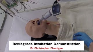 Retrograde Intubation Demonstration [upl. by Nolham]