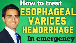 Esophageal Varices amp Variceal Hemorrhage Treatment and ManagmentSTEP WISE APPROACH [upl. by Nnair]