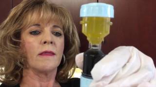 How to prepare Platelet Rich Plasma [upl. by Iden]