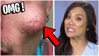 Top 7 Most DISGUSTING Extractions on Dr Pimple Popper [upl. by Gunnar]