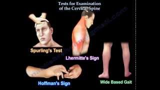 Tests For Examination Of The Cervical Spine  Everything You Need To Know  Dr Nabil Ebraheim [upl. by Supmart283]