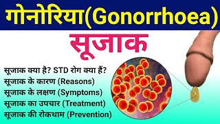 सूजाक रोग  Gonorrhea Causes Symptoms Diagnosis Treatment  Gonorrhea disease  sujak rog  STD [upl. by Bland]