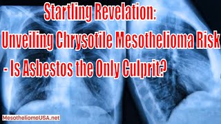 Chrysotile Mesothelioma Risk  Is Mesothelioma Always Caused by Asbestos Exposure [upl. by Celeste33]