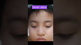 Deadalive [upl. by Fadil]