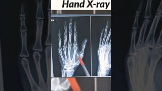 radiological foot xray machine Radiation short medical student doctor [upl. by Dlareme932]