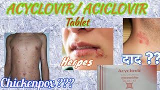 Acyclovir tablets  Herpikind  Herpikind Tablet  Zovirax  Zovirax tablets  uses side effects [upl. by Ragucci]