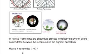 Retinitis Pigmentosa [upl. by Aylad489]