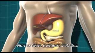 Diabetes and the body  Diabetes UK [upl. by Unni]