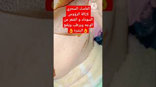 طريقة وصفه لازاله والشعر من الوجه وتنظيف البشرةوصفات تجميل وصفاتللوجهاكسبلور متابعه لايك [upl. by Delle]