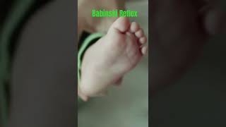 quotNewborn Babys Babinski Reflex Fascinating Developmental MilestonequotNewbornBabinskiReflex newborn [upl. by Leahicm677]