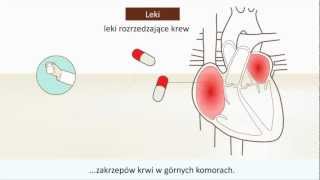 Arytmie  Co to jest [upl. by Nedarb]