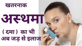 Asthma Treatment  Ashthma Ka Ilaj In Hindi  Sans Ki Bermari Ka Ayurvedic Ilaj BeeanAyurveda [upl. by Harwilll499]