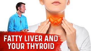 Why Can A Fatty Liver Slow Your Thyroid Hypothyroid – Dr Berg [upl. by Anelahs]