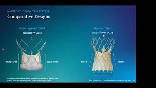 Implante de válvula aórtica percutánea con navitor ventajas y retos  José Francisco Díaz [upl. by Rehpotirhc]