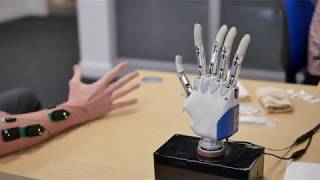 Improving the control of prosthetic hands [upl. by Gomer150]