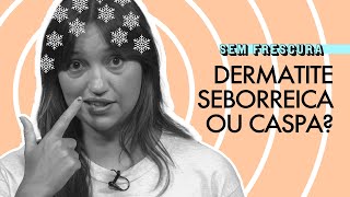 Seborreia é o mesmo que caspa Sem Frescura explica [upl. by Julianna]