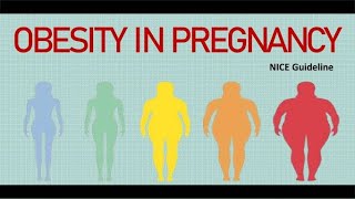 Obesity in Pregnancy RCOG Guideline [upl. by Ulu]