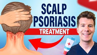 Doctor explains FOUR TREATMENTS for SCALP PSORIASIS [upl. by Anelhtak712]