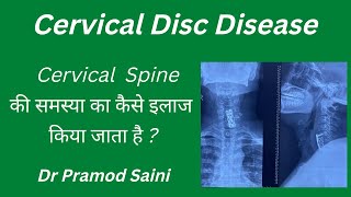 Cervical Spodylosis Cervical Myelopathy and Radiculopathy Diagnosis and Treatment [upl. by Kamat]