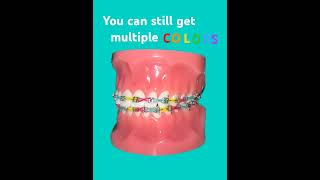 Cute colors ideas for braces power chain [upl. by Coppins]