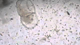 giardia Lambilia cysts amptrophozoites [upl. by Sky866]