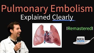 Pulmonary Embolism Remastered  Pathophysiology Symptoms Diagnosis DVT [upl. by Warfield]