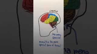 Le ASSURDE TEORIE di CESARE LOMBROSO 🧠 lombroso criminale teoria frenologia imparaconyoutube [upl. by Catherine837]