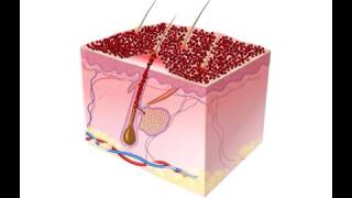 Lutronic Laser  碳粉激光 Spectra Peel [upl. by Neerehs845]