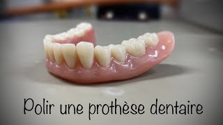 Prothèse dentaire supérieure et inférieure  finition dune prothèse [upl. by Fenny]