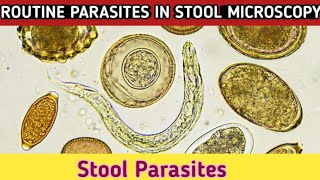 Routine Parasites in stool microscopy Stool Parasites under microscope [upl. by Jenette770]