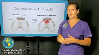 Can chondromalacia patella be treated with Prolotherapy FAQ about knee degeneration and arthritis [upl. by Nihi409]