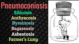 Pneumoconiosis  Silicosis  Anthracosis  Asbestosis  PSM lecture  Community Medicine lecture [upl. by Gunning]