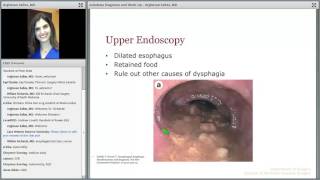 SAGES Webinar Feb 2017 WorkUp and Treatment of Achalasia [upl. by Romine52]