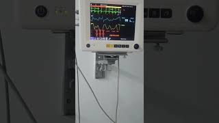 A Last Hope for ICU Patients 🩺👩🏻‍⚕️ youtube shorts viralreels [upl. by Peatroy]