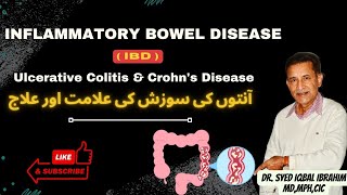 Inflammatory Bowel Disease IBD Ulcerative Colitis amp Crohn’s Disease [upl. by Adnuahsor]