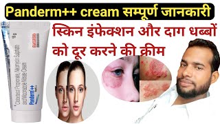 Panderm cream  Panderm cream  Panderm cream use in Hindi  pendram cream ke fayde [upl. by Havot590]