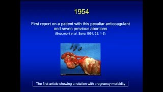 Antiphospholipid syndrome [upl. by Enamrahs]