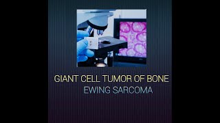 Giant cell tumor of bone amp Ewing sarcoma giantcelltumor ewingsarcoma systemicpathology [upl. by Jacinda]