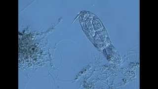 rotifer ingesting filamentous bacteria in activated sludgem1v [upl. by Atniuq]