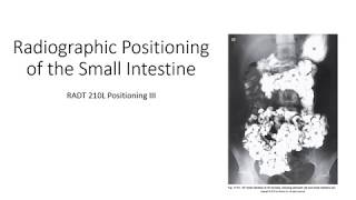 Radiographic Positioning of the Small Intestine [upl. by Rosa752]